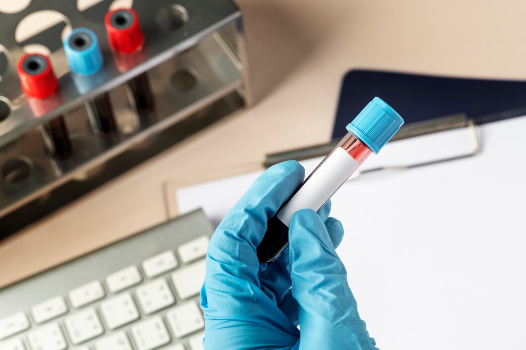 Blood Test & Analysis - Manage Lab Results with Ease